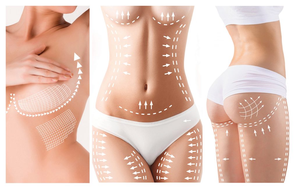 Cosmetic Surgery Procedures